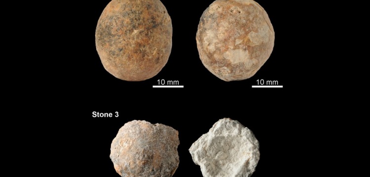 12 bin yıllık prostat taşları bulundu