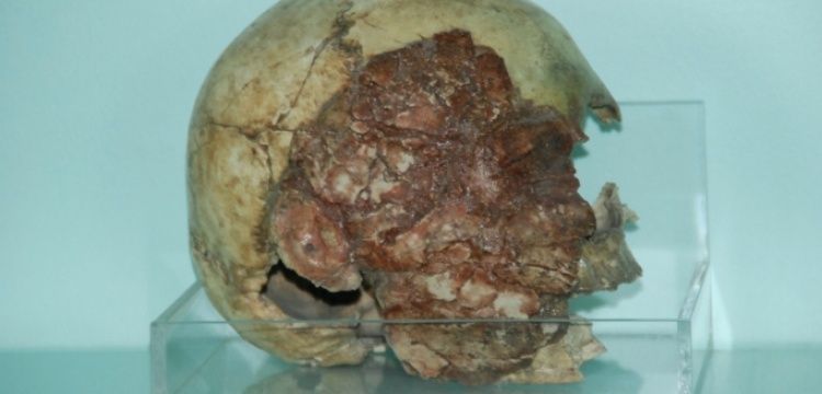 Niğde Müzesinde 13 tane 7.500 yıllık kil sıvalı insan kafatası var