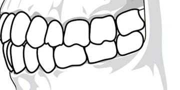 How scars on hominins tooth surface are formed?