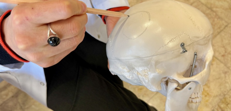 Efsaneden Gerçeğe: Çatalhöyük'teki kafatası Neolitik'te beyin ameliyatı ihtimalini güçlendirdi