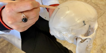 Efsaneden Gerçeğe: Çatalhöyükteki kafatası Neolitikte beyin ameliyatı ihtimalini güçlendirdi