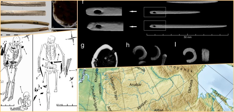 Neolitik İğne Kutularının İçine Tomografi ile Bakıldı: Taş Devri Trendi Binlerce Yıl Sürmüş